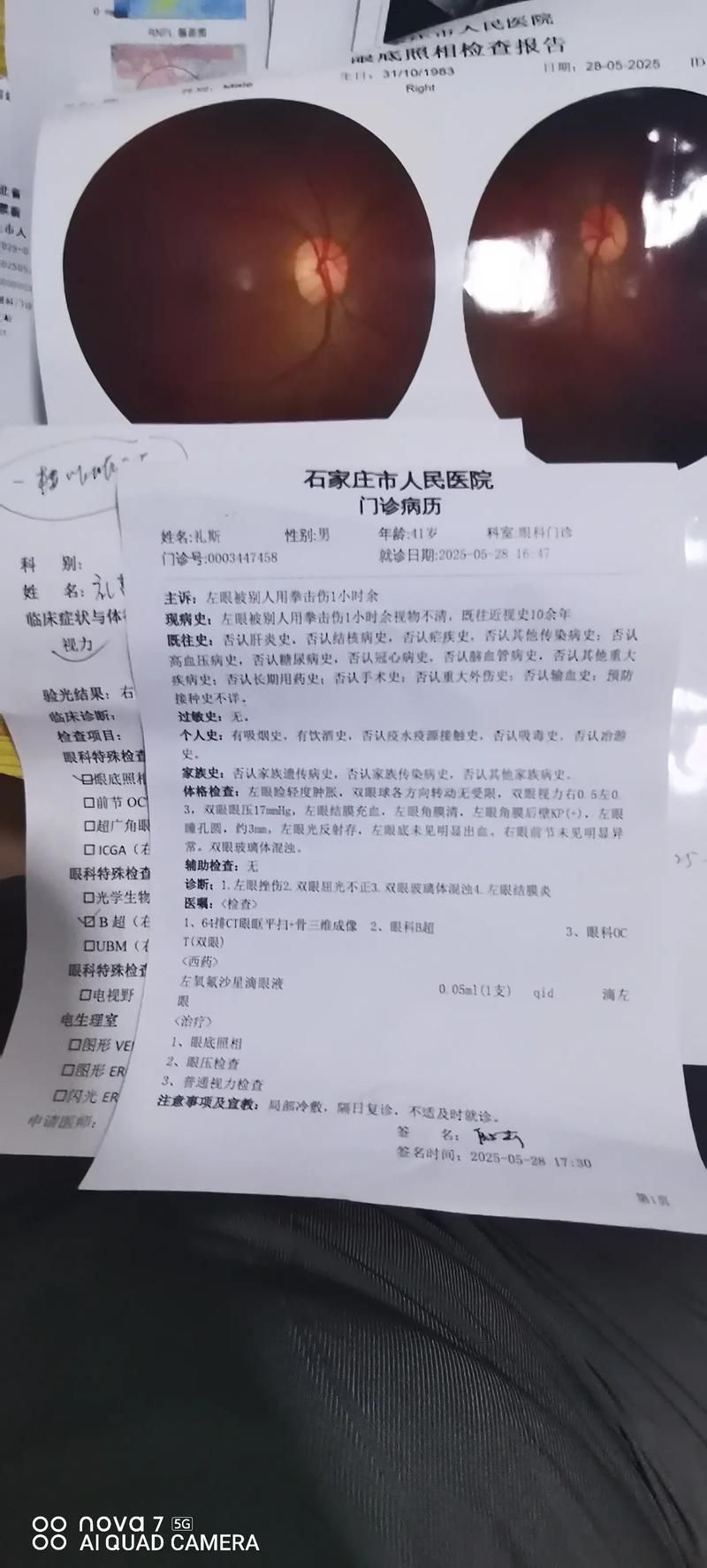 丛台区近期新增8例重症_丛台区近期新增8例重症病例
