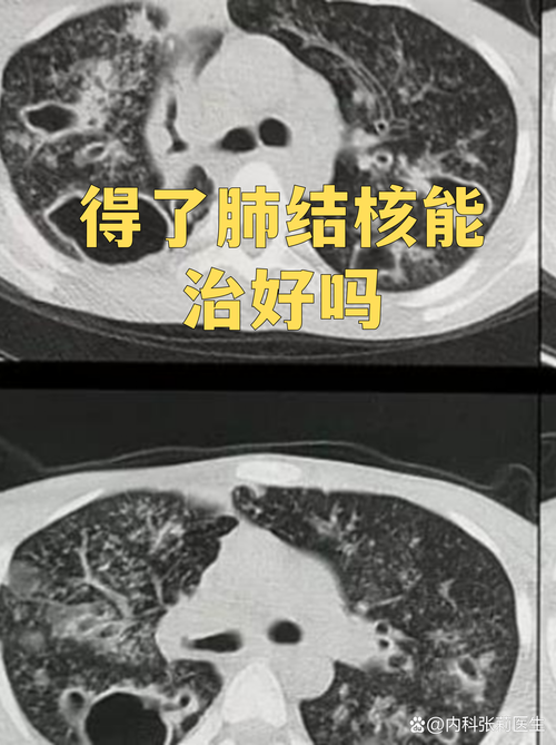 【7地新增无症状感染者13例均在山西朔州山西朔州经济开发区_山西朔州确诊新型肺炎】