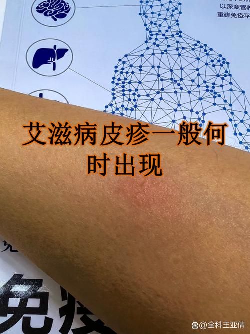 硚口区现有无症状感染者2例(硚口区有没有疫情)