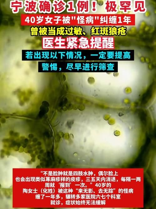 专家:浙江省嘉兴市海宁市每年或现多个感染高峰(嘉兴海宁确诊)