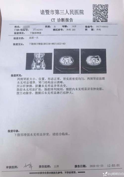 平顶山昨日无新增境外输入:平顶山有一例疑似病例