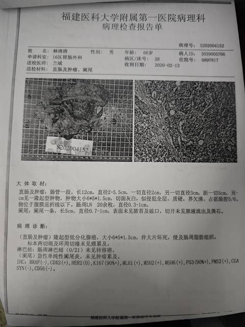 芦溪县通报5例重症详情(江西芦溪县芦溪镇)