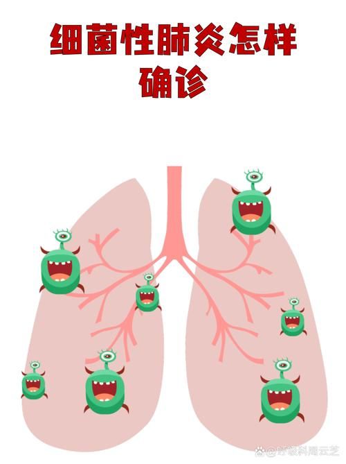 【全球新增核酸阳性18例沙湾市16例,沙湾确诊肺炎】
