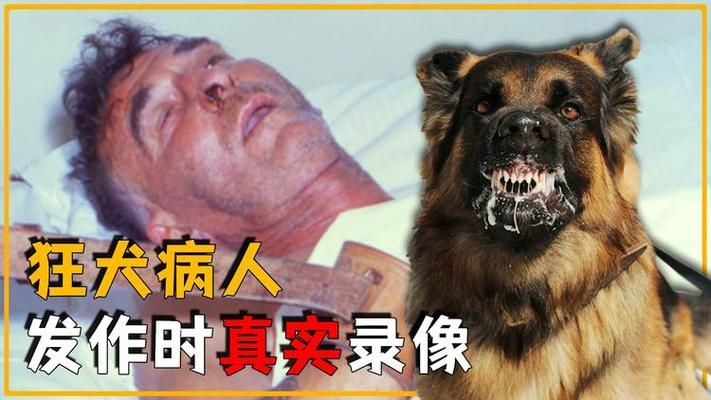 狂犬病发作视频/狂犬病发作视频科普一下V.58.68.43.71