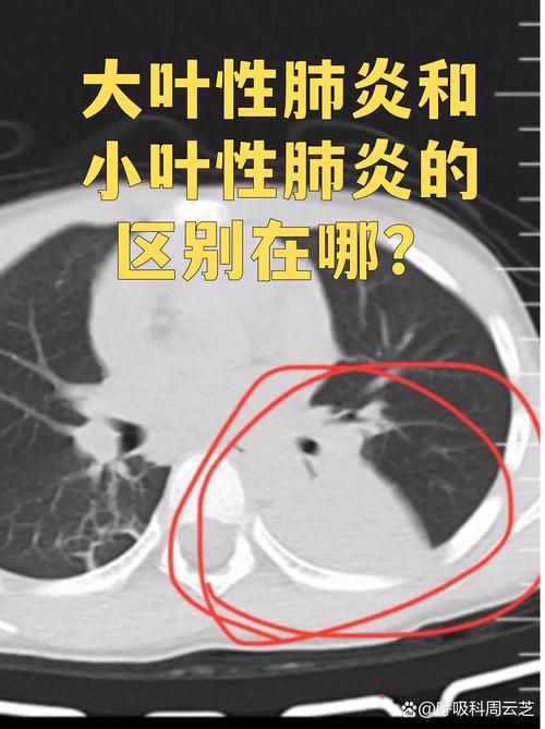 一张图看懂浙江嘉兴海盐县11月28日疫情通报/嘉兴海盐有新型肺炎吗