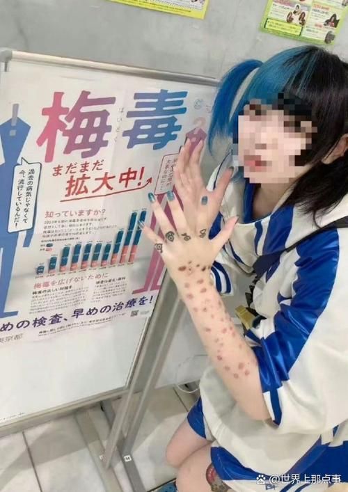 全球近6天新增29例阳性感染者/全球新增确诊超56万例