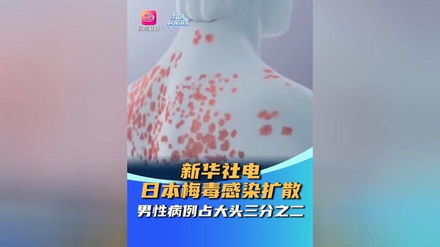 【大朗镇今冬新增28例阳性感染者,大朗新冠状病毒最新疫情】