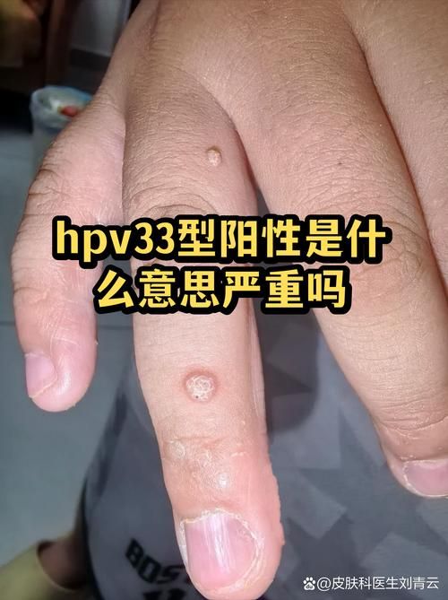 浙江阳性感染者已回落26地:浙江有阳性感染是真假